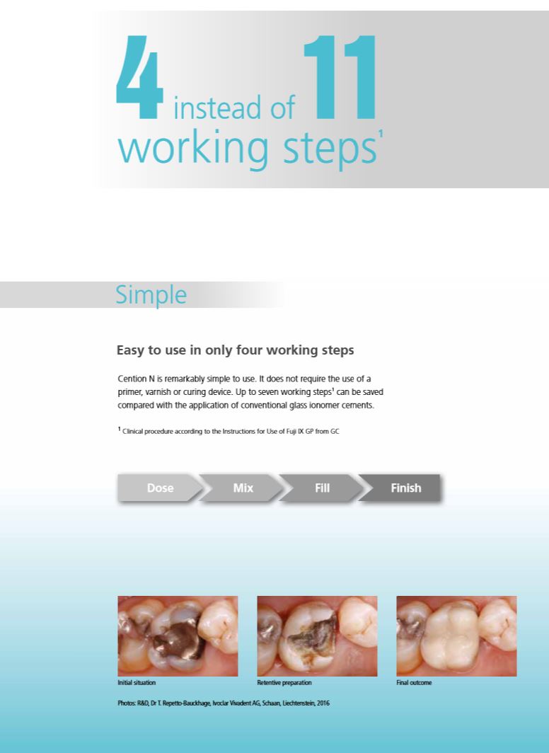 Cention® N Amalgam Alternative