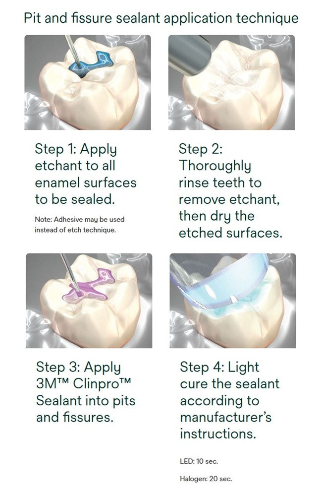 Clinpro™ Sealant Refill, 1.2ml