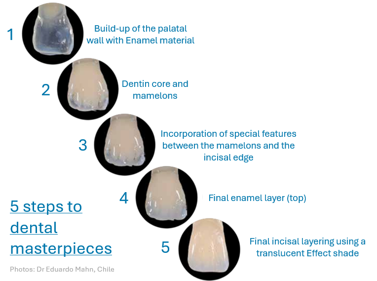 IPS Empress® Direct High Esthetic Composite