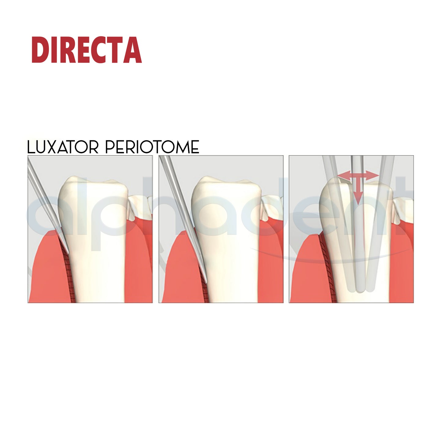 The Original Luxator® Periotome Knives