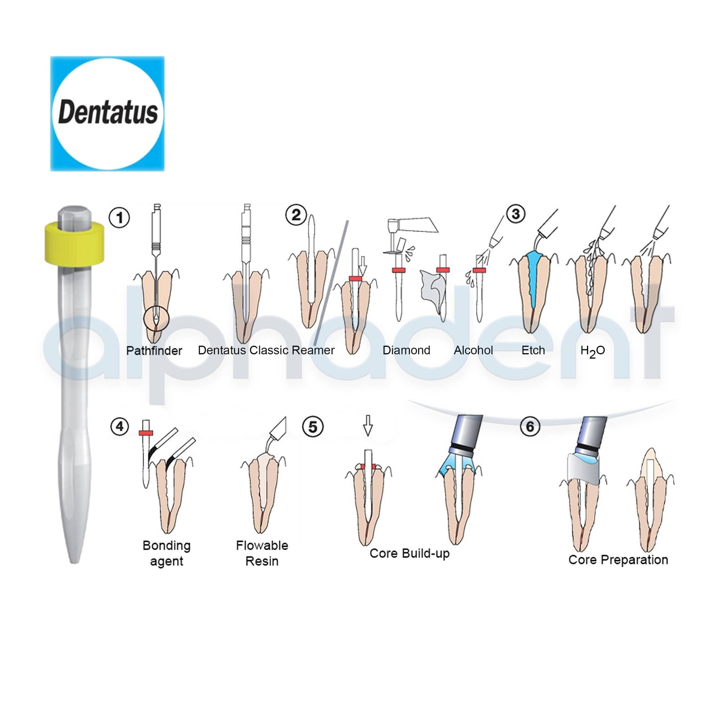 Twin Luscent Fiberglass Dental Posts