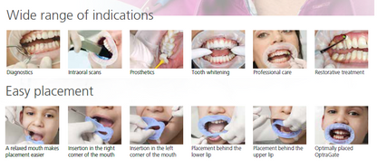 OptraGate® Lip & Cheek Retractor (pack of 10)