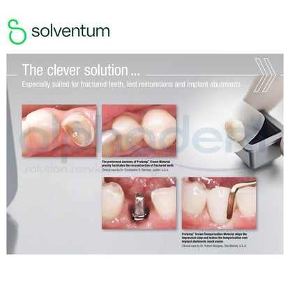 Protemp™ 4 Temporization material
