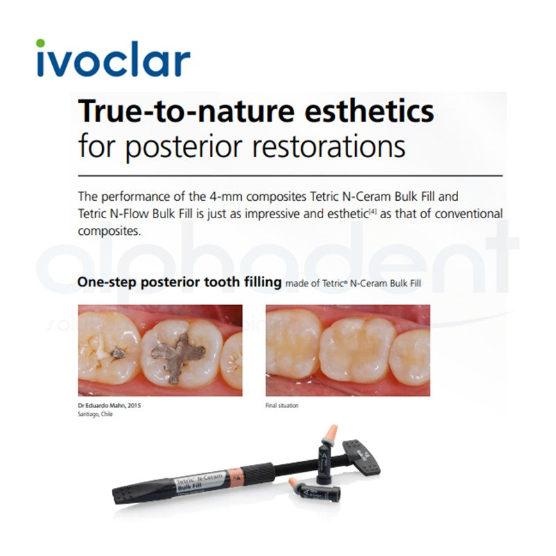 Tetric® N-Ceram Bulk Fill Composite, 3.5g