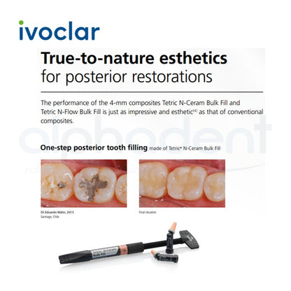 Tetric® N-Ceram Bulk Fill Composite, 3.5g