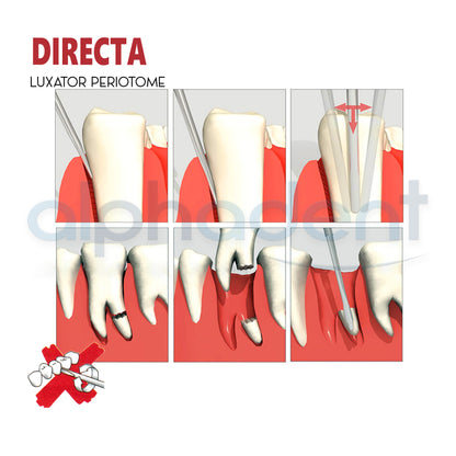 The Original Luxator® Periotome Knives